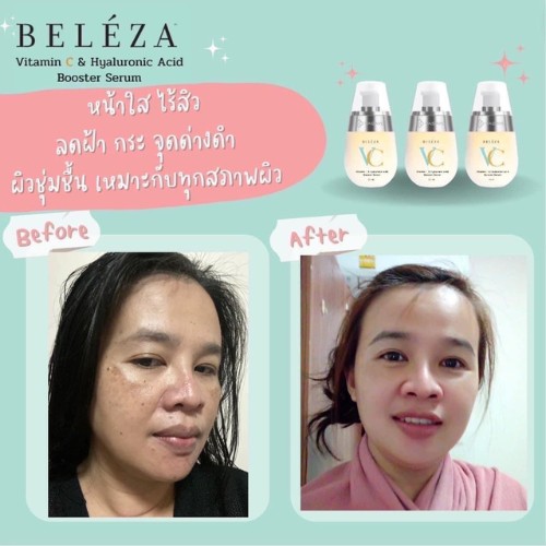 beleza vc เบเลซ่า วีซี รีวิว 3