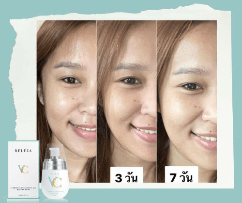 beleza vc เบเลซ่า วีซี รีวิว