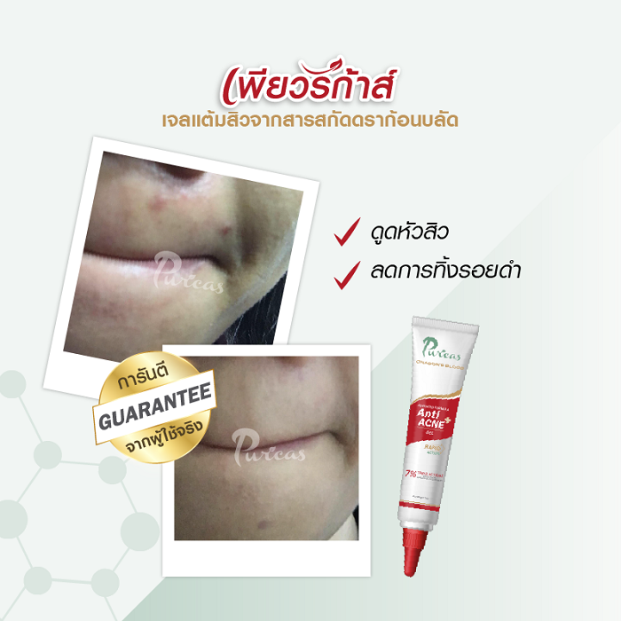 Puricas Dragon’s Blood Anti Acne Gel เพียวริก้าส์ ดราก้อนบลัด แอนตี้เอคเน่ เจล เจลแต้มสิว