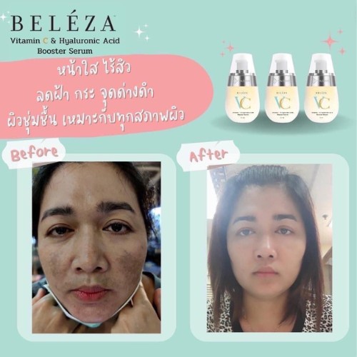 beleza vc เบเลซ่า วีซี รีวิว 1