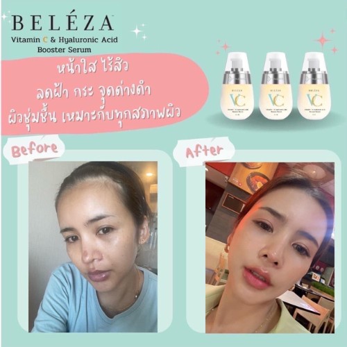beleza vc เบเลซ่า วีซี รีวิว 2