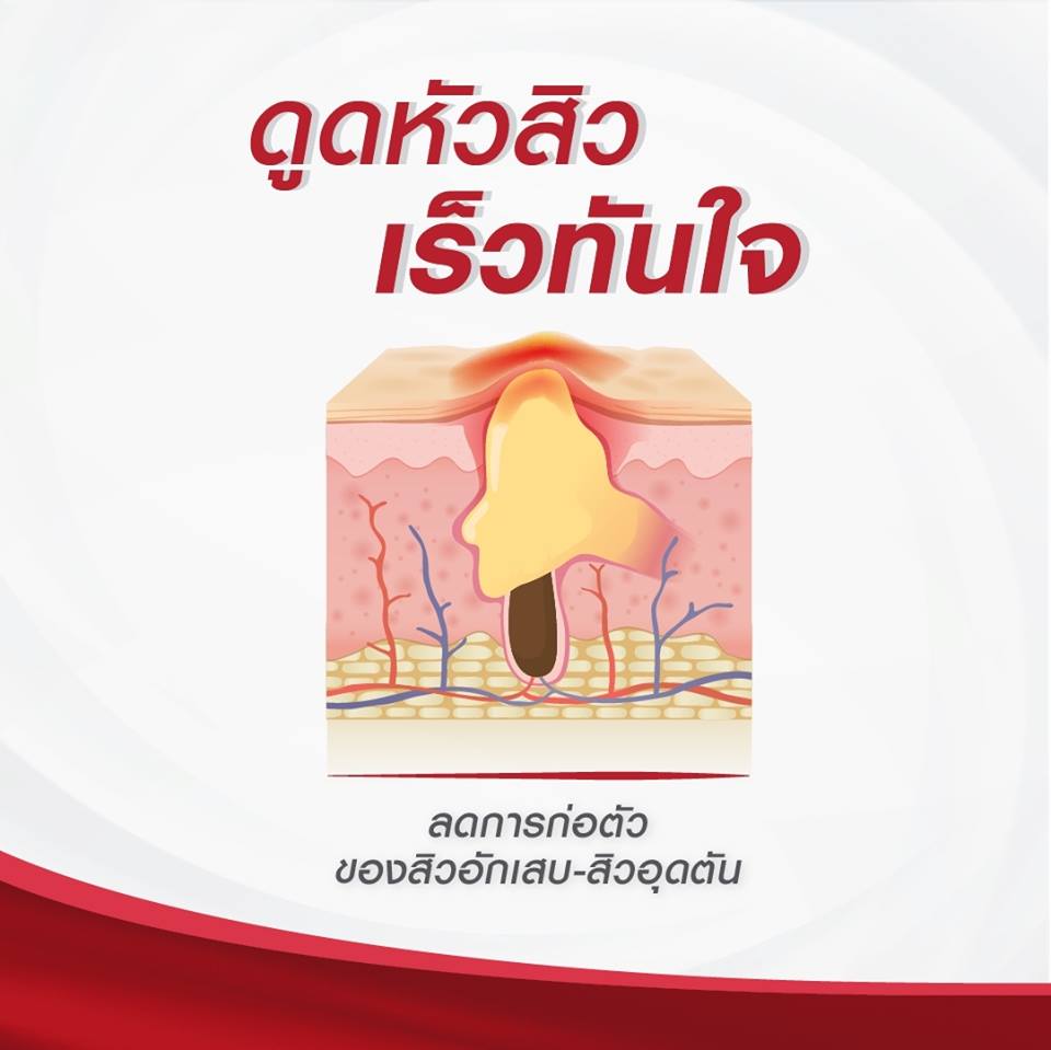 Puricas Dragon’s Blood Anti Acne Gel เพียวริก้าส์ ดราก้อนบลัด แอนตี้เอคเน่ เจล เจลแต้มสิว
