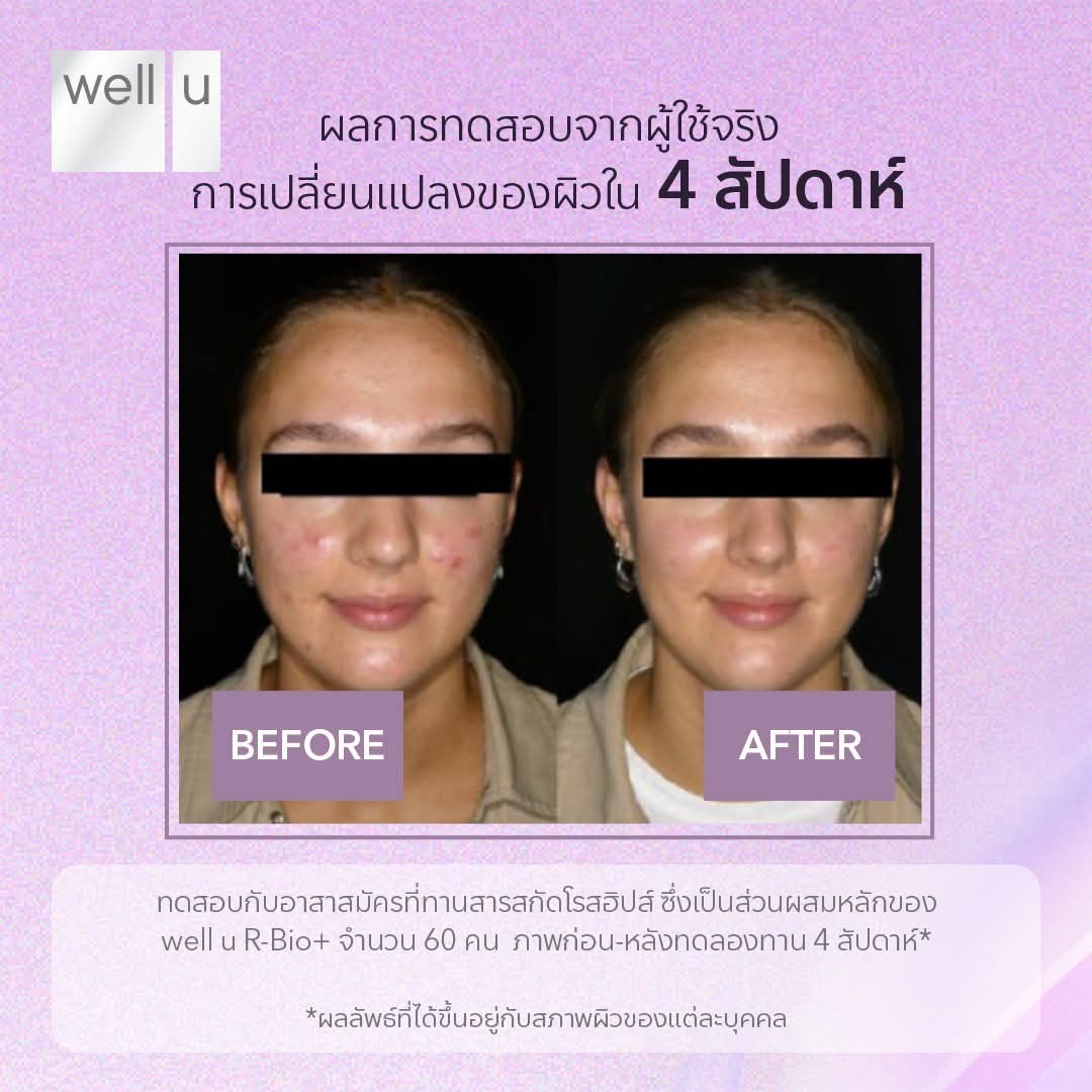 well u R-Bio Plus